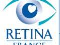 Retina